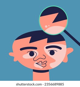 Vitiligo people. Boy with white pigment spots on his face at an appointment with a doctor who looks at the skin through a magnifying glass. World Vitiligo Day. Flat vector illustration.