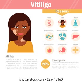 Vitiligo. Pigmentation disorders. Isolated art on white background. Vector. Cartoon. Flat. For websites, brochures, magazines. Medicine