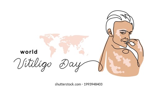 Banner vectorial simple de la piel de Vitiligo, afiche, fondo. Persona con pigmentación cutánea. Un dibujo de línea continua y el día del vitiligo mundial.