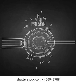 In vitro fertilisation. Artificial insemination. Graphic medical illustration. Vector design isolated on chalkboard