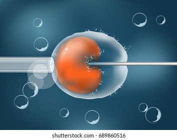 In vitro fertilisation. IVF. Cell under microscope. Human egg on gray background. vector. Illustration easy editable for Your color of background.