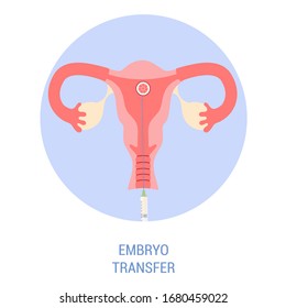 In-vitro-Fertilisationsschritt. Embryo in den Uterus stecken. Künstliche Schwangerschaft mithilfe moderner Technik. Einzelbild