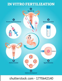 In Vitro fertilization artificial pregnancy reproduction vector illustration. Labeled educational explanation with all procedure process steps and phases. Gynecological solution for human infertility.