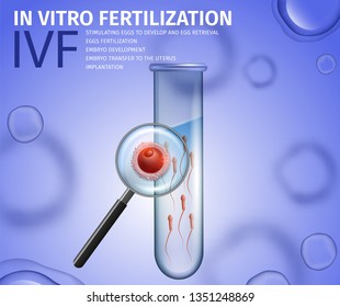 In Vitro Fertilization. Close Up View Through Magnifier Glass Into Test Tube with Sperm and Womans Egg Cell. Human Reproduction. IVF Stages. Vector Realistic Illustration. Medical Banner, Copy Space.