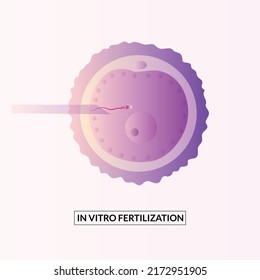 In vitro fertilization concept. Artificial insemination and pregnancy.