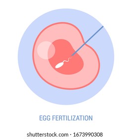 In vitro fertilization concept, artificial fertilization of woman egg in a laboratory. Female egg and male sperm. Microscopic view. Vector illustration