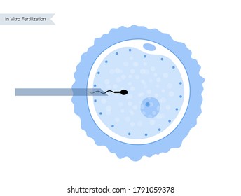 In Vitro Fertilization Concept. ICSI Technology. Artificial Insemination And Pregnancy Concept. Human Egg Cell Icon. Genetic And Medical Poster For Clinic Or Laboratory. Flat Vector Illustration.