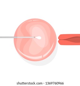In vitro fertilization concept. Idea of infertility and problem with reproduction. Artificial pregnancy with modern technology. Insemination process. Isolated vector illustration in cartoon style