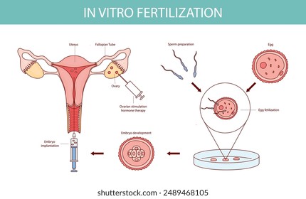 In vitro fertilization diagram drawn in cartoon style.