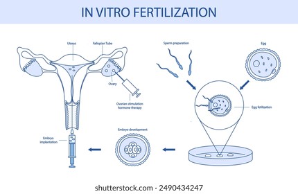 In vitro fertilization diagram drawn in cartoon style.