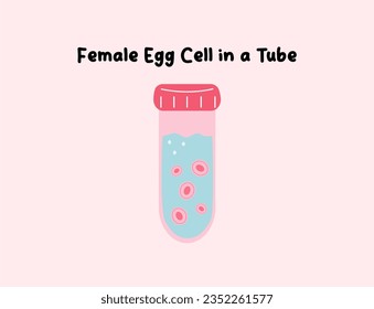 In vitro fertilization. Egg cell illustration. Sperm collecting. Medical poster for clinic. Idea of infertility and problem with reproduction. Artificial pregnancy with modern technology. Insemination