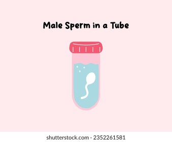 In vitro fertilization. Egg cell illustration. Sperm collecting. Medical poster for clinic. Idea of infertility and problem with reproduction. Artificial pregnancy with modern technology. Insemination