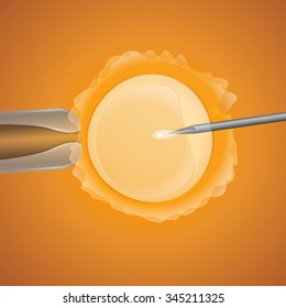 in vitro fertilization, the egg is the holding pipette and needle close up on a yellow background