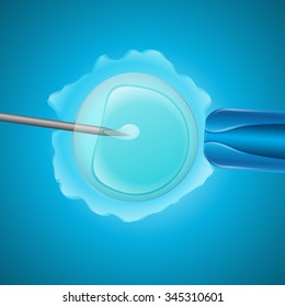 Fecundación in vitro, el óvulo es la pipeta de retención y la aguja de cerca sobre un fondo azul