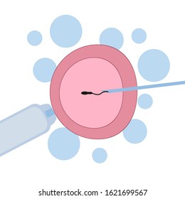 In Vitro Fertilization flat illustration. Human Fertilized Egg in Laboratory Petri Dish. Artificial Insemination ICSI Ovum Cell with Needle and Sperm. IVF. Vector Illustration, White background.