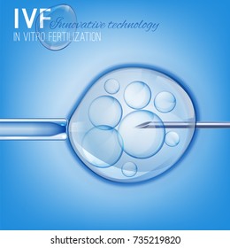 Imagen de Fertilización In Vitro. Inseminación artificial. Ilustración médica científica. Diseño vectorial en colores azul claro.