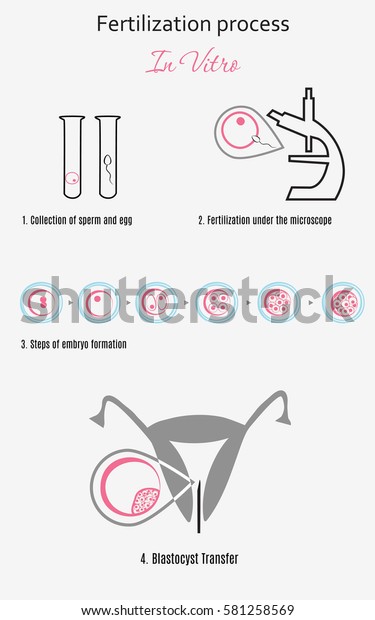 Vitro Fertilization Infographic Chart Scheme Artificial Stock Vector Royalty Free 581258569 3628