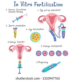 Vitro Fertilization Infographic Flat Handdrawn Style Stock Vector ...