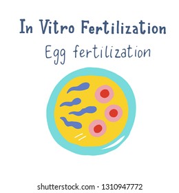 In vitro fertilization infographic in flat and handdrawn style with hand lettering. Scheme of artificial insemination. Egg fertilization. Vector illustration for scientific manual 