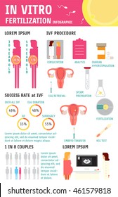 In vitro fertilization infographic.Charts and pregnancy elements vector illustration. Vector file is easy to edit.