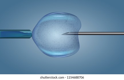 In Vitro Fertilization injection. Artificial insemination. Scientific medical illustrated vector.
