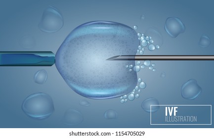In Vitro Fertilization injection. Artificial insemination. Scientific medical illustrated vector.