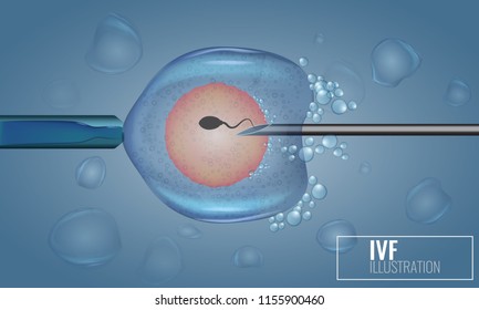 In Vitro Fertilization injection. Artificial insemination. Scientific medical illustrated vector.