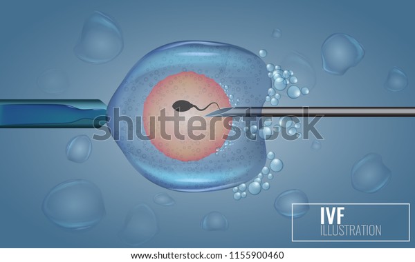 Vitro Fertilization Injection Artificial Insemination Scientific Stock Vector Royalty Free 8376