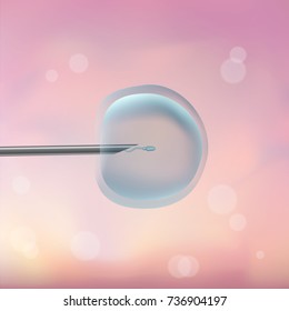 In vitro fertilization IVF. Artificial insemination. ICSI. The ovum egg , needle and spermatozoon. Illustration for web or typography magazine, brochure, flyer, poster. Blurred pink background