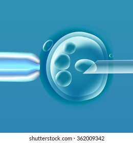 In vitro fertilization (IVF), the egg (ovum), pipette and pipe horizontal, reproduction in humans illustration for an article, site or typography (magazine, brochure, flyer, poster), light blue.