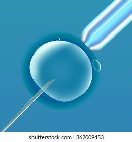 In vitro fertilization (IVF), the egg (ovum), pipette and pipe diagonal, reproduction in humans illustration for an article, site or typography (magazine, brochure, flyer, poster), light blue