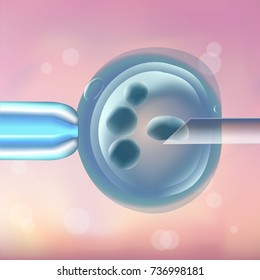 In vitro fertilization IVF, the egg, ovum, pipette and pipe horizontal, reproduction in humans illustration for an article, site, typography magazine, brochure, flyer, poster. Blurred pink background.