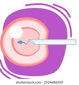 In Vitro fertilization IVF medical infographic and infertility treatment scheme. Ovarian hyperstimulation, artificial insemination, embryo culture and cryopreservation. Medical procedure for pregnancy