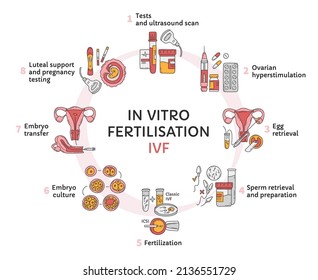 In Vitro fertilization IVF vector circle infographic, infertility treatment scheme. Ovarian hyperstimulation, artificial insemination, embryo culture, luteal support. Medical procedure for pregnancy