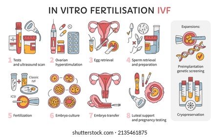 In Vitro fertilization IVF vector infographic and infertility treatment scheme. Ovarian hyperstimulation, artificial insemination, embryo culture and cryopreservation. Medical procedure for pregnancy