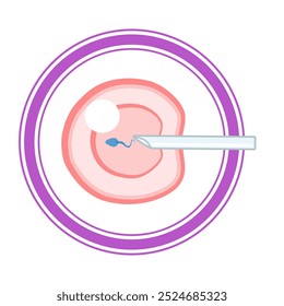 Fertilização in vitro esquema de infográfico e tratamento da infertilidade do vetor FIV. Hiperestimulação ovárica, inseminação artificial, cultura de embriões e criopreservação. Procedimento médico para gravidez.