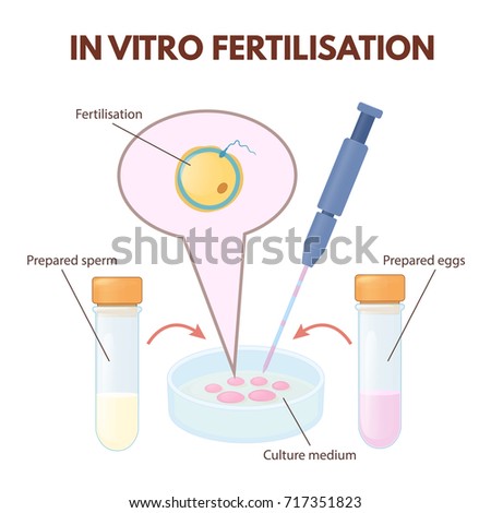 Bondage story whipping Sperm fertilization poor division