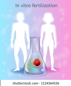 In Vitro Fertilization Realistic Vector Concept With Human Fertilized Egg In Laboratory Petri Dish Illustration. Modern Methods Of Infertility Treatment, Gestational Surrogacy, Sperm And Egg Donation