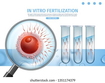 In Vitro Fertilization. Sperm Cells Flowing to Egg Trough Magnifier Glass View. Test Tubes with Spermatozoons. Pregnancy, Reproduction, IVF. Vector Realistic Illustration. Medical Banner, Copy Space.