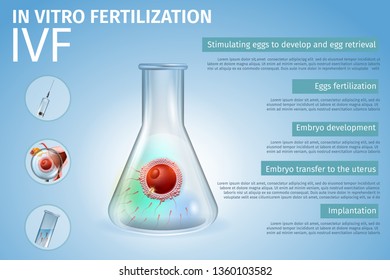 In Vitro Fertilization Stages Process Composition. Union of Human Egg and Sperm Inside of Beaker. Spermatozoons in Test Tube. Reproductive System Technology. IVF. Vector Realistic Illustration. Banner