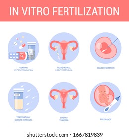 Vitro Fertilization Stepbystep Method Artificial Pregnancy Stock Vector ...