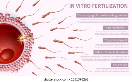 In Vitro Fertilization Steps List. Sperm Cells Flowing to Womans Egg on Pink Background. IVF Reproductive Medicine. Vector Realistic Illustration. Medical Banner for Reproduction Clinic, Copy Space.