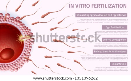 In Vitro Fertilization Steps List. Sperm Cells Flowing to Womans Egg on Pink Background. IVF Reproductive Medicine. Vector Realistic Illustration. Medical Banner for Reproduction Clinic, Copy Space.