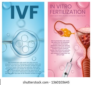 In Vitro Fertilization Vertical Banner Set. IVF. Female Eggs Fertilised in Laboratory and Surgically Implanted Into Woman Womb Microscopic Research. Vector Realistic Illustration. Banner, Copy Space