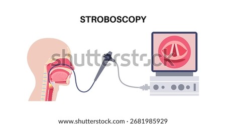 Vocal cords stroboscopy. Larynx anatomy, glottis, airflow and phonation. ENT concept, otolaryngology and speech therapy. Diagnosis, stroboscopy and surgical education in respiratory medicine vector