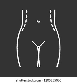 Waist correction surgery chalk icon. Flanks liposuction. Waist contouring and fat removal plastic surgery. Isolated vector chalkboard illustration