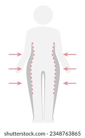 Pictograma para la pérdida de peso en la cintura para reducir el exceso de grasa. Editable. Ilustración vectorial de la figura de la mujer con sobrepeso, líneas punteadas y flechas para la remoción de grasa y celulitis. Icono de silueta de cuerpo femenino delgado