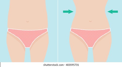 Waist weight loss vector illustration before and after result