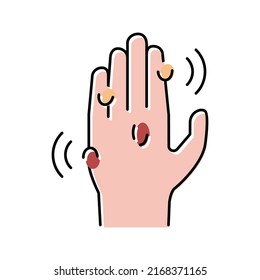 warts disease color icon vector. warts disease sign. isolated symbol illustration