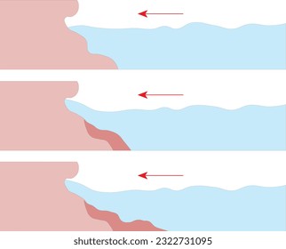 Wave erosion, sea, mountain (Geography Lesson), Erozyon, Rüzgar, Deniz, Dağ, Dalga, Coğrafya, Coğrafya Dersi,Water erosion, External forces Geography